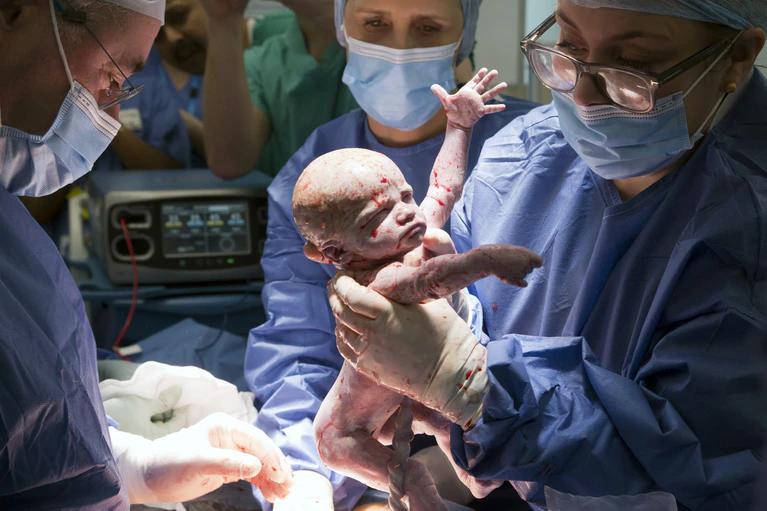Es soll der erste solche Fall in Großbritannien gewesen sein. — © Womb Transplant Uk/PA Media/dpa